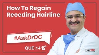 How To Regain Receding Hairline  AskDrDc Ep 14  HairMD Pune  In HINDI [upl. by Attey915]