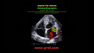 Echokardiographie  Schritt Für Schritt [upl. by Sterling]