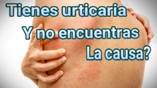 Mi experiencia con urticaria y sarpullido por fin encontré la causa [upl. by Abbotsen]