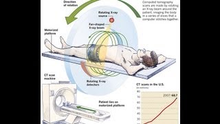 How CT Scan Machine Works [upl. by Peterman]