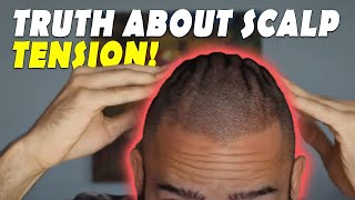 The Truth about Scalp Tension and Scalp Massage for Hair Regrowth [upl. by Atoel431]