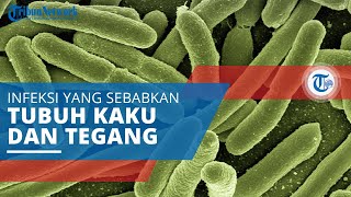 Tetanus Infeksi yang Diakibatkan karena Bakteri hingga Menyebabkan Tubuh Menjadi Kaku dan Tegang [upl. by Aidan237]