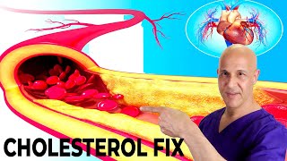 The Most Effective Way to Lower Your Cholesterol Naturally in 7 Days Dr Mandell [upl. by Annaujat]