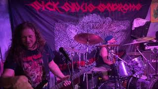 SICK SINUS SYNDROME  LIVE FORENSIC AUTOPSY IN OSTRAVA  ROCK HILL 2021 [upl. by Yelnats142]