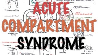 Compartment Syndrome  Overview signs and symptoms pathophysiology treatment [upl. by Garnet956]