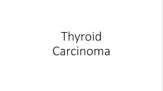 Thyroid Carcinoma  For Medical Students [upl. by Millhon700]