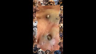 Blackhead Removal  18  Blackhead extraction  blackheads [upl. by Yesrod]