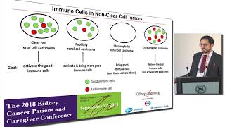 Systemic treatment options for patients with metastatic nonclear cell renal cell carcinoma [upl. by Drofhsa420]