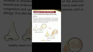 Rhinitis  typesetiologyrisk factor management complications symptoms diagnosis shorts viral [upl. by Joella186]