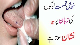 Meaning Of Mole On Tongue In Urdu  Personality Trait  Anam Home Remedy [upl. by Emya943]