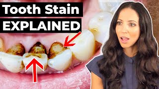 Dental Hygienist EXPLAINS Why Teeth Stain [upl. by Lac290]