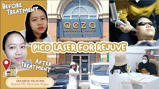 TREATMENT PICO LASER FOR REJUVE  QEZA CLINIC  NISA AZZAROH [upl. by Attelrac360]