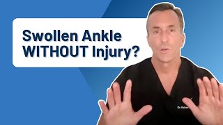 What Causes Ankle Pain and Swelling WITHOUT Injury [upl. by Ruberta]