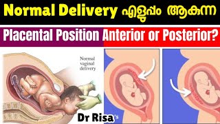 പ്രസവം എളുപ്പമാകുന്ന Placental Position  Anterior amp Posterior Placenta [upl. by Layne608]