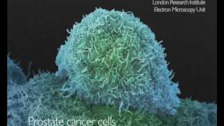 Electron microscopy of cancer cells from Cancer Research UKfunded scientists [upl. by Lucchesi424]