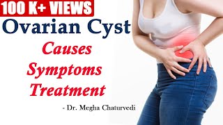 Ovarian Cyst Causes Symptoms and Treatment [upl. by Millham288]