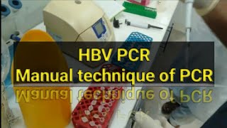 HBV PCR test PCR test Manually [upl. by Nodarse]