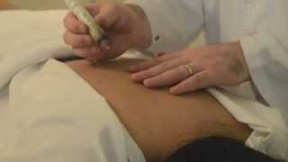 Demonstration of Moxibustion Treatment [upl. by Westmoreland]