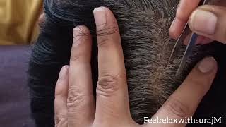 Scratching Dandruff of scalp [upl. by Acisej]