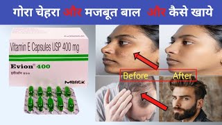 Evion 400 capsule uses in Hindi  Evion 400 capsule  Vitamin E capsule [upl. by Ilek]