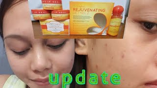 SKIN MAGICAL REJUVENATING SET 2 UPDATEEXPERIENCETIPS [upl. by Rhianon]