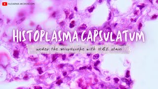 Histoplasma capsulatum under the microscope with Haematoxylin and Eosin HampE stain [upl. by Anicart385]