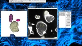 Tutorial LimeSeg 1  Multiple objects segmentation [upl. by Dumas454]