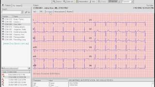 CardioPerfect Patient  ECGwmv [upl. by Auos653]