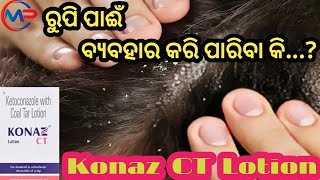 ରୁପି ପାଈଁ ବ୍ଯବହାର କରିବା Konaz CT Lotion Uses for Dandruff Psoriasis Skin infection Allergies Re [upl. by Lenehc745]