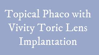 Topical Phaco with Vivity Toric IOL Implantation [upl. by Rosalia]