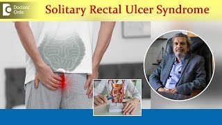 Ulcer on bottomSolitary Rectal Ulcer SyndromeCauses amp TreatmentDrRajasekhar M R Doctors Circle [upl. by Eisseb188]