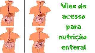 AULA 70 VIAS DE ACESSO PARA NUTRIÇÃO ENTERAL [upl. by Assilaj]