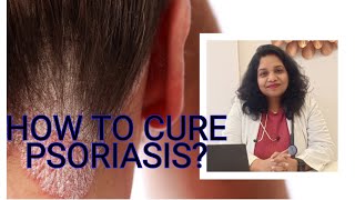 Homeopathic Treatment For Psoriasis  DrRitu Bansal [upl. by Zanahs]