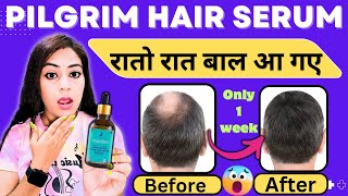 Pilgrim Redensyl and Anagain Advanced Hair Growth Serum Review  Pligrim Hair Serum  Hair Growth [upl. by Nayek452]