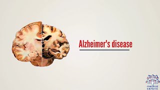 What is Alzheimers disease Causes Signs and Symptoms Diagnosis and Treatment [upl. by Anayrb917]