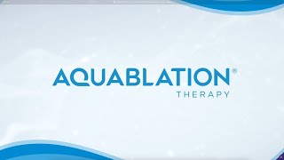 Aquablation® Therapy A GameChanger in BPH Treatment [upl. by Akeme710]