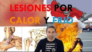 LESIONES POR FRIO Y CALOR  TRAUMATISMOS [upl. by Ymas458]