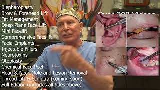 Niamtu Live 4K Live Cosmetic Facial Surgery Video Series [upl. by Nobel]