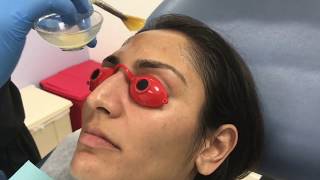 Dr Patel performs a SkinCeuticals Pigment Balancing Peel [upl. by Stone]