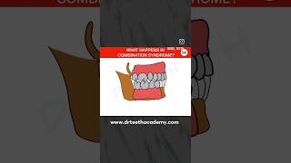 Combination Syndrome drteeth [upl. by Gusba]