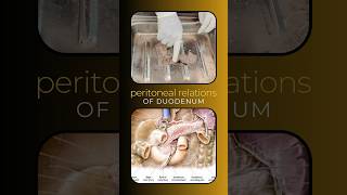 Peritoneal relations of duodenum anatomy of duodenum duodenumanatomy relationsofduodenum [upl. by Diego]