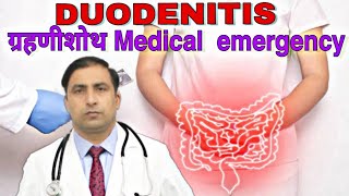 DUODENITIS ग्रहणीशोथ Medical emergency  Dr kumar education clinic [upl. by Sayer]