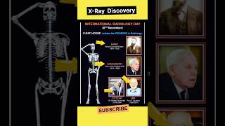 X rays Discovery  international radiology day trending viral shorts [upl. by Ardnat265]