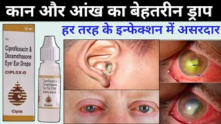 ciplox d eye ear drops  ciprofloxacin dexamethasone eye ear drops ciplox d uses in hindi [upl. by Ahsinek545]