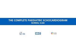 The complete paediatric echocardiogram  Normal scan [upl. by Bullard]