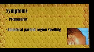 Acute parotitis in neonates Patient teaching programme Tamil [upl. by Kehsihba]