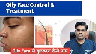 Oily face को कैसे कंट्रोल करें  How to Control Oily Skin  Cause amp Cure [upl. by Eerised]