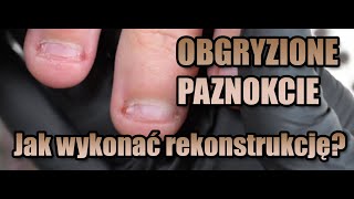 ACRYGEL REKONSTRUKCJA PAZNOKCI OBGRYZIONYCH 💗 [upl. by Aikar]