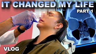 SEPTOPLASTY SURGERY IT CHANGED MY LIFE  VLOG  PART 1 [upl. by Supat]