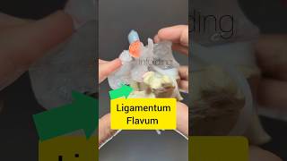 Ligamentum Flavum Modelling  Dynamic Disc Designs [upl. by Dyrrej]